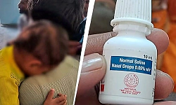 Toddler loses vision after doctors allegedly use nasal drops in eyes