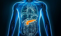 Acute Pancreatitis: When stomach pain becomes a medical emergency 