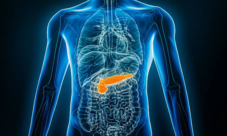 Acute Pancreatitis: When stomach pain becomes a medical emergency 