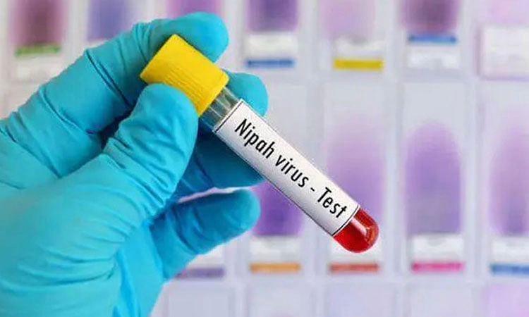 Nipah; ಬಂಗಾಲದಲ್ಲಿ ನಿಫಾ ಪ್ರಕರಣಗಳು ದೃಢ: ವಿಶ್ವ ಆರೋಗ್ಯ ಸಂಸ್ಥೆ ಹೇಳಿದ್ದೇನು?