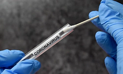 Covid-19 case confirmed in Bidar; health authorities on high alert