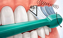 ಹುಳಿತೇಗು: ಹಲ್ಲುಗಳಿಗೆ ಹೇಗೆ ಹಾನಿ ಮಾಡಬಲ್ಲುದು?