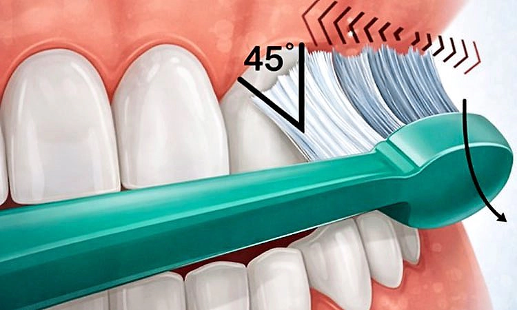 ಹುಳಿತೇಗು: ಹಲ್ಲುಗಳಿಗೆ ಹೇಗೆ ಹಾನಿ ಮಾಡಬಲ್ಲುದು?