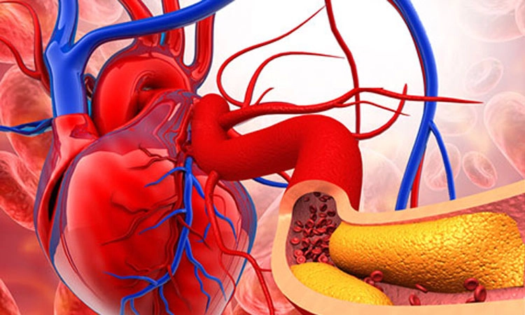 Heart Health: ಹೃದಯ ಆರೋಗ್ಯದಲ್ಲಿ ಕೊಲೆಸ್ಟರಾಲ್‌ನ ಪಾತ್ರ