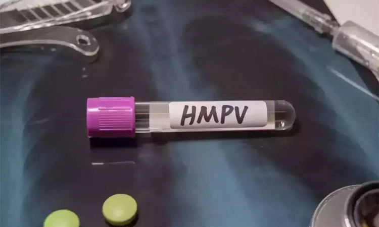HMPV ವೈರಸ್‌ ಪ್ರಕರಣ ಕಡಿಮೆಯಾಗಿದೆ: ಚೀನ ಸರಕಾರ