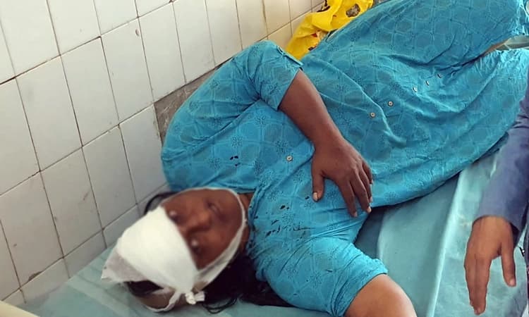 ಚಿನ್ನ ಕಸಿಯಲು ಬಂದ ದುಷ್ಕರ್ಮಿಯಿಂದ ಮಹಿಳೆಗೆ ರಾಡ್ ನಿಂದ ಹಲ್ಲೆ: ಆಸ್ಪತ್ರೆಗೆ ದಾಖಲು