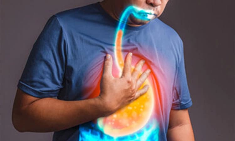 Acidity: ಆಮ್ಲೀಯತೆ ನಿವಾರಣೆಗೆ ಅತ್ಯುತ್ತಮ ಆಹಾರಗಳು