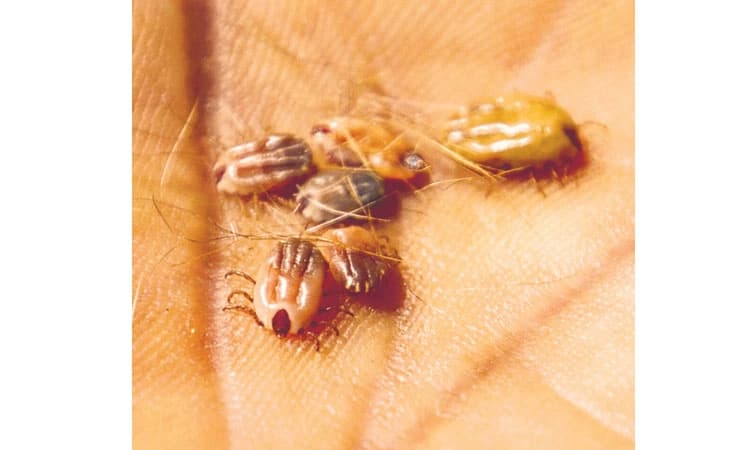 Monkey disease: ಉಣುಗುಗಳಲ್ಲಿ ಮಂಗನ ಕಾಯಿಲೆ ವಂಶವಾಹಿ ಪ್ರಸರಣ!