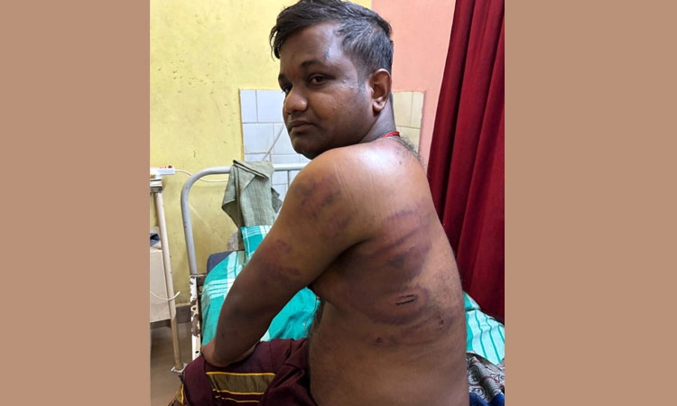 Padubidiri: ಸಾಲ ವಾಪಸ್‌ ನೀಡದ್ದಕ್ಕೆ ಯಕ್ಷಗಾನ ಕಲಾವಿದನಿಗೆ ದೈಹಿಕ ಹಲ್ಲೆ