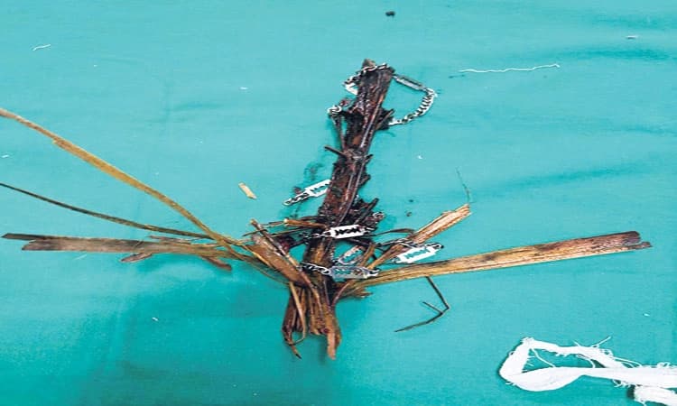 Mangaluru: ಆಟವಾಡುತ್ತಿದ್ದ ಬಾಲಕನ ಎದೆಯೊಳಗೆ ಹೊಕ್ಕ ತೆಂಗಿನ ಗರಿ, ಸರ!