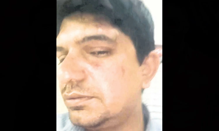Arrested: ಗ್ಲಾಸ್‌ ಎಸೆದಿದ್ದನ್ನು ಪ್ರಶ್ನಿಸಿದ್ದಕ್ಕೆ ಪ್ರೊಫೆಸರ್‌ಗೆ ಹಲ್ಲೆ