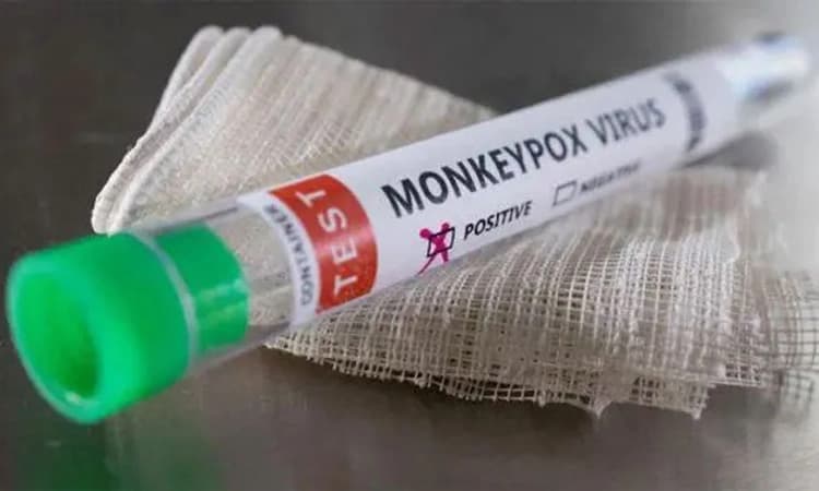 ಮಂಕಿಪಾಕ್ಸ್ ; ಸೆಕ್ಸ್ ಜತೆಗಾರರ ಸಂಖ್ಯೆ ಕಡಿಮೆ ಮಾಡಿ: ವಿಶ್ವ ಆರೋಗ್ಯ ಸಂಸ್ಥೆ ಸಲಹೆ