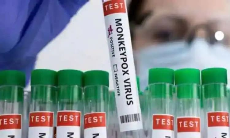 ವಿದೇಶದಿಂದ ಮಂಗಳೂರು ವಿಮಾನ ನಿಲ್ದಾಣಕ್ಕೆ ಬಂದ ಕೇರಳದ ಯುವಕನಲ್ಲಿ ಮಂಕಿಪಾಕ್ಸ್‌ ಲಕ್ಷಣ?