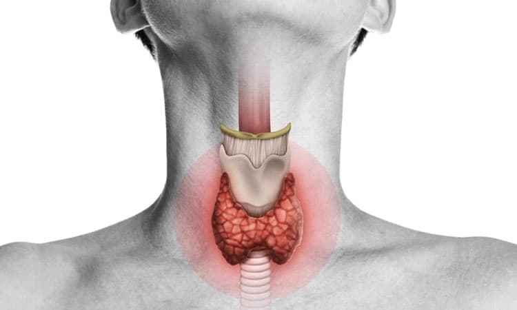 Thyroid Disease: ಥೈರಾಯ್ಡ್ ಅನಾರೋಗ್ಯ ನಿರ್ಲಕ್ಷಿಸಿದರೆ ಮಾರಕವಾದೀತು ಎಚ್ಚರ!