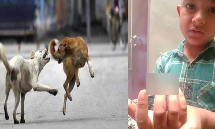 ಮಡಿಕೇರಿ: ಪಾದಾಚಾರಿಗಳ ಮೇಲೆರಗುತ್ತಿರುವ ಬೀದಿ ನಾಯಿಗಳು: ಇಬ್ಬರಿಗೆ ಗಾಯ