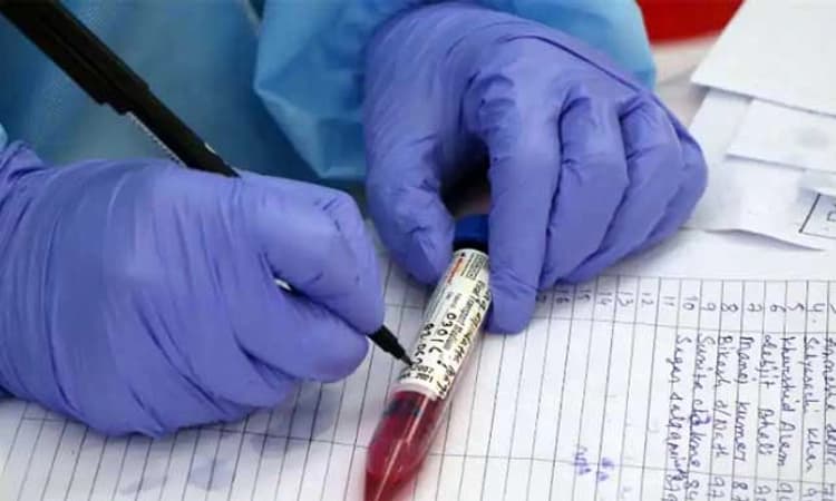 238 ದಿನಗಳ ನಂತರ ಮತ್ತಷ್ಟು ಇಳಿಕೆ; ಭಾರತದಲ್ಲಿ 12,428 ಕೋವಿಡ್ ಪ್ರಕರಣ ಪತ್ತೆ