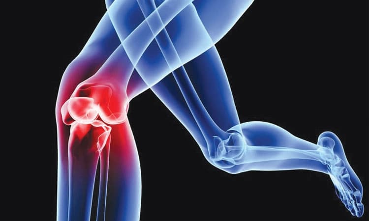 ಪೆರಿ-ಪ್ರೋಸ್ಥೆಟಿಕ್‌ ಸೋಂಕು – ನೀವು ತಿಳಿಯಬೇಕಾದದ್ದು