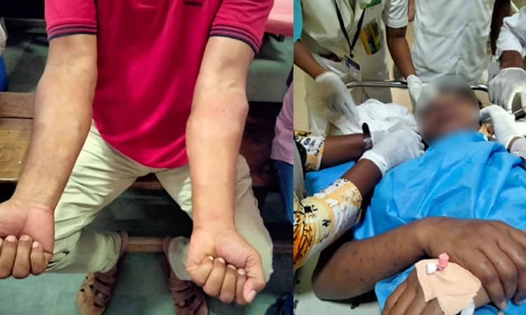 ಹುಬ್ಬಳ್ಳಿಯಲ್ಲಿ ಹೆಜ್ಜೇನು ದಾಳಿ: ಎಸ್ಸೆಸ್ಸೆಲ್ಸಿ ಪರೀಕ್ಷಾರ್ಥಿಗಳು ಆಸ್ಪತ್ರೆಗೆ