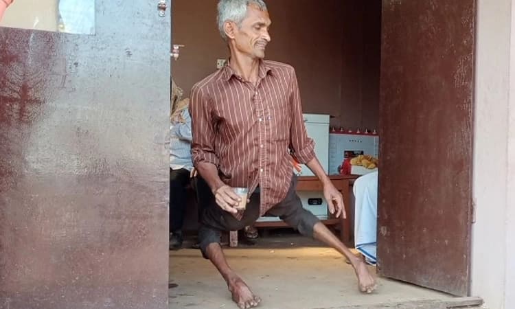 ವಿಕಲಚೇತನ ಸ್ವಾವಲಂಬಿ ಬದುಕಿಗೆ ಹೊಟೇಲ್‌ ಆಸರೆ