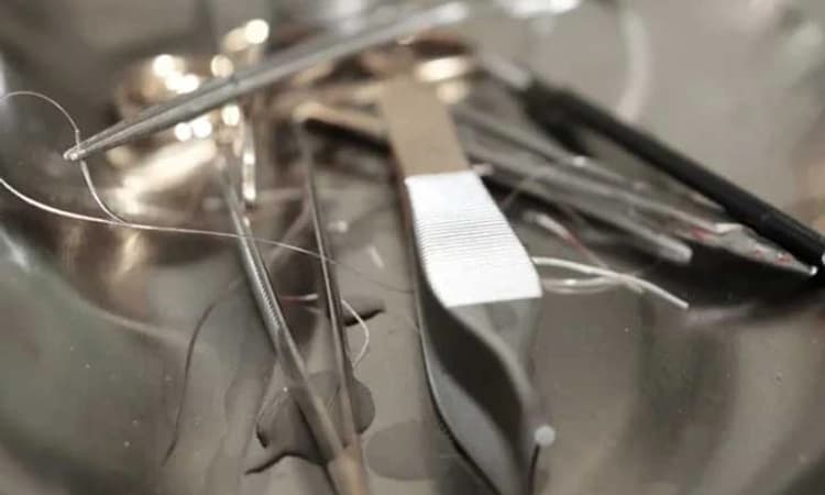 ನಕಲಿ ವೈದ್ಯನಿಂದ ಸರ್ಜರಿ…ಕೊನೆಯುಸಿರೆಳೆದ ಎರಡೂವರೆ ವರ್ಷದ ಮಗು; FIR ದಾಖಲು