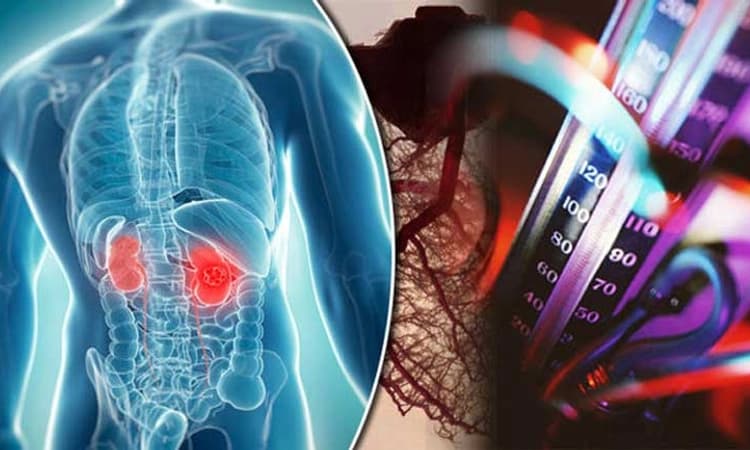 ಅಧಿಕ ರಕ್ತದೊತ್ತಡ ಕಾಯಿಲೆಯಿಂದ ಮೂತ್ರಪಿಂಡ ವೈಫಲ್ಯ ಸಮಸ್ಯೆ ಹೇಗೆ ಉಂಟಾಗಲಿದೆ?