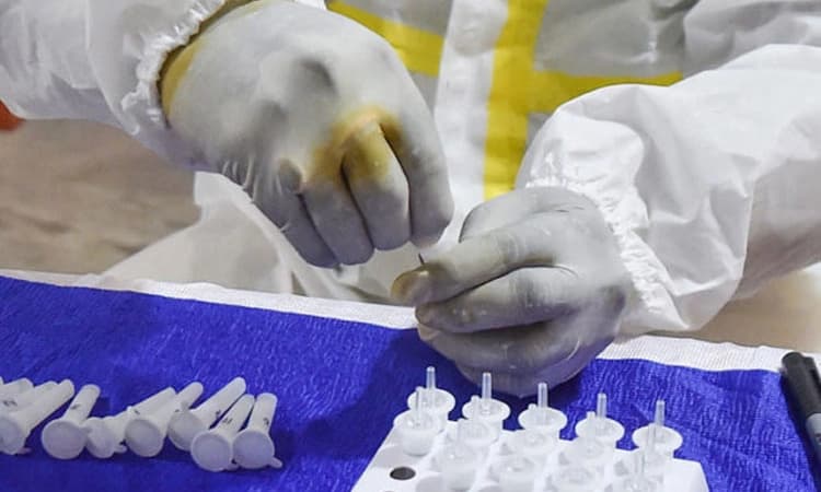 ತೀರ್ಥಹಳ್ಳಿ ವ್ಯಕ್ತಿಗೆ ಕೆಎಫ್‌ಡಿ ಸೋಂಕು ಪ್ರಕರಣ ಪತ್ತೆ