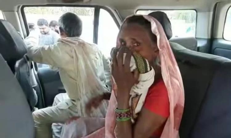 ಮಧ್ಯಪ್ರದೇಶದಲ್ಲೊಂದು ವಿಚಿತ್ರ ಘಟನೆ: ಪತ್ನಿ ದೂರವಾದಳೆಂದು ಅತ್ತೆಯ ಮೂಗನ್ನೇ ಕಚ್ಚಿದ ಅಳಿಯ