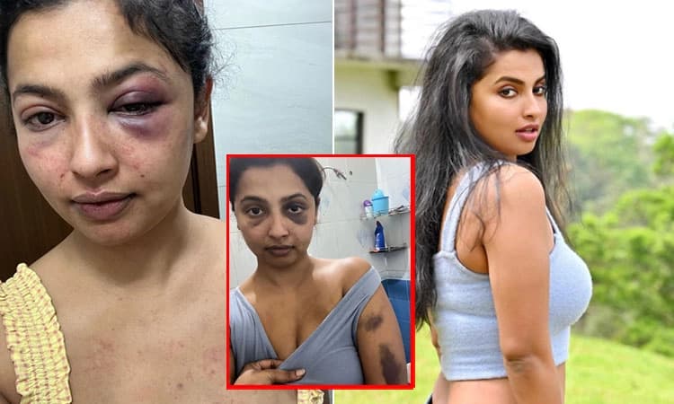 ಮಾಜಿ ಗೆಳೆಯನಿಂದ ಹಿಗ್ಗಾಮುಗ್ಗಾ ಥಳಿತಕ್ಕೊಳಗಾದ ಖ್ಯಾತ ನಟಿ: ಸ್ಕ್ರೀನ್‌ ಶಾಟ್‌, ಫೋಟೋ ವೈರಲ್