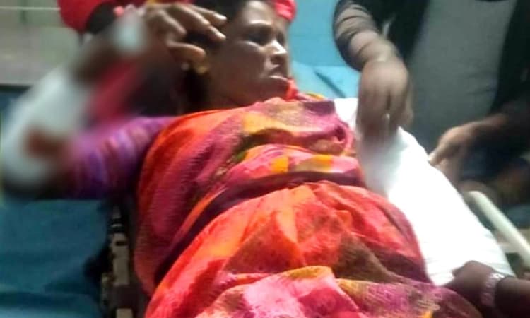 ಕೌಟುಂಬಿಕ ಕಲಹ: ಪತ್ನಿ ಮೇಲೆ ಮಚ್ಚಿನಿಂದ ಹಲ್ಲೆ ನಡೆಸಿ ಪರಾರಿಯಾದ ಪತಿ