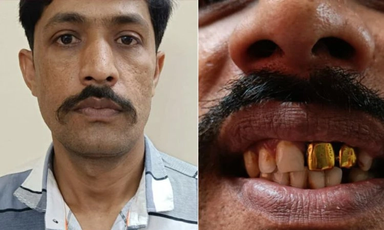 15 ವರ್ಷಗಳಿಂದ ಪೊಲೀಸರಿಗೆ ಸಿಗದೆ ತಲೆಮರೆಸಿಕೊಂಡಿದ್ದವನಿಗೆ ಆತನ ಹಲ್ಲುಗಳೇ ಮುಳುವಾಯಿತು