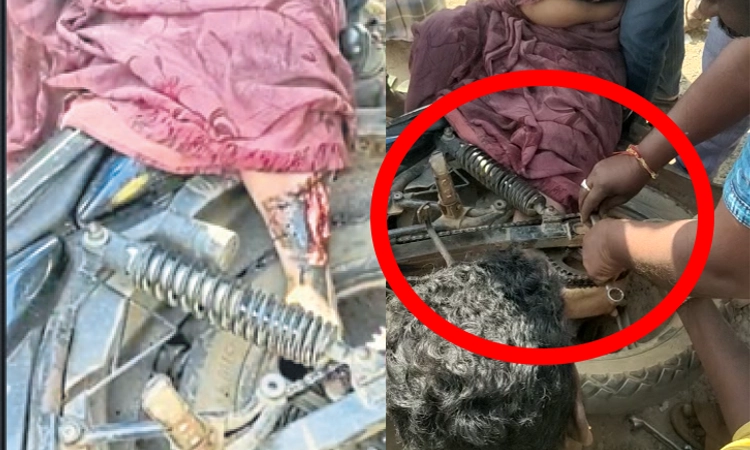ಮಹಿಳೆಯರೇ ಎಚ್ಚರವಹಿಸಿ: ಸೀರೆ ಜೊತೆ ಬೈಕ್ ಚಕ್ರಕ್ಕೆ ಸಿಲುಕಿದ ಮಹಿಳೆಯ ಕಾಲು