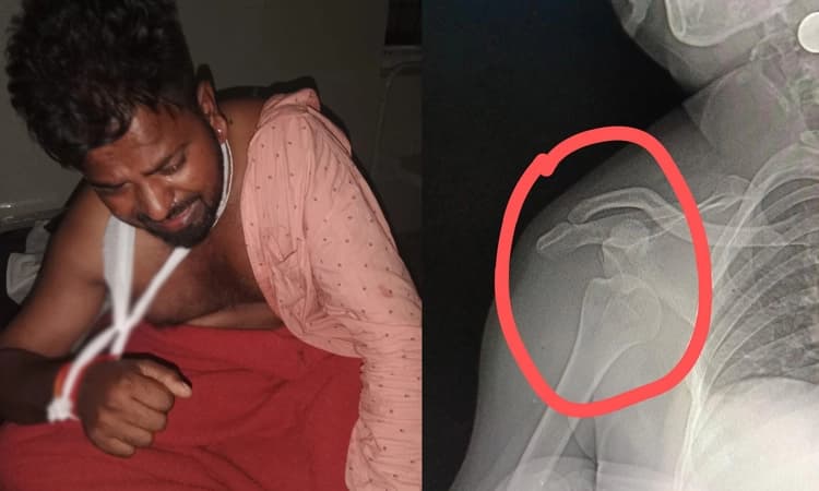 ಕಾಂಗ್ರೆಸ್ ತೊರೆದು ಬಿಜೆಪಿ ಸೇರ್ಪಡೆಯಾಗಿದ್ದ ಕಾರ್ಯಕರ್ತನ ಮೇಲೆ ಮಾರಣಾಂತಿಕ ಹಲ್ಲೆ