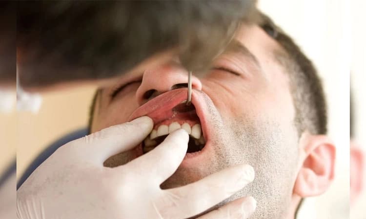 ಹಲ್ಲಿನ ಸೋಂಕು; ಸಂಧಿ ನೋವಿಗೆ ಕಾರಣವಾದೀತೇ ?