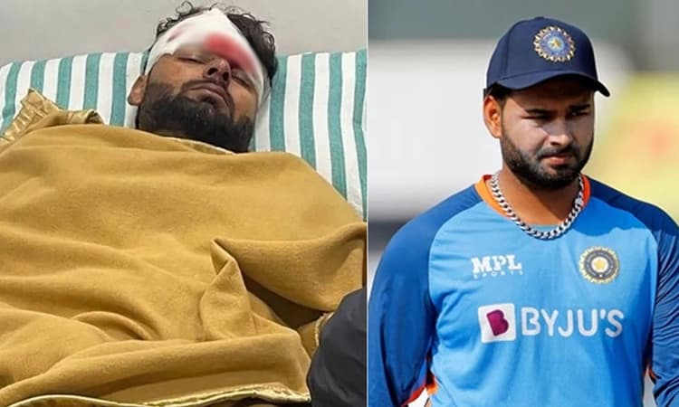 ರಿಷಭ್‌ ಪಂತ್‌ಗೆ ಬೇಕಿದೆ ಆರು ತಿಂಗಳು ವಿಶ್ರಾಂತಿ: 2023ರ ಐಪಿಎಲ್‌ಪಂದ್ಯಾವಳಿಯಲ್ಲಿ ಆಡುವ ಸಾಧ್ಯತೆ ದೂರ