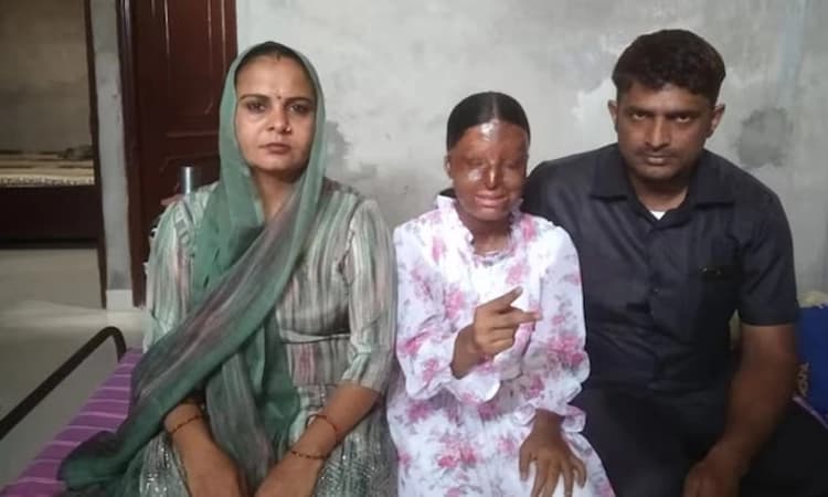 CBSE 10th Result ಆಸಿಡ್ ದಾಳಿಯಲ್ಲಿ ದೃಷ್ಟಿ ಕಳೆದುಕೊಂಡವಳಿಗೆ 95.20% ಅಂಕ !