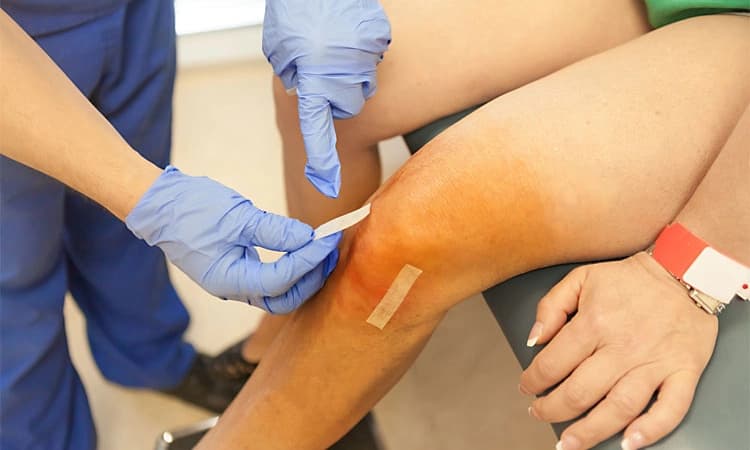 Arthroscopic surgery ಹಾಗೆಂದರೇನು?