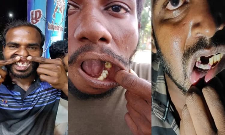 ವಿಚಾರಣೆ ನೆಪದಲ್ಲಿ ಖೈದಿಗಳ ಹಲ್ಲನ್ನೇ ಕಿತ್ತ ಐಪಿಎಸ್ ಅಧಿಕಾರಿ ಕರ್ತವ್ಯದಿಂದ ಅಮಾನತು