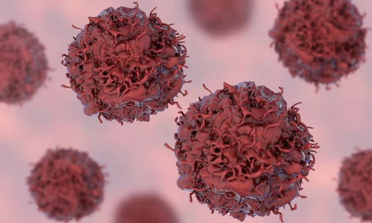 Cancer Cases: ದೇಶದಲ್ಲಿ ಕ್ಯಾನ್ಸರ್ ಕೇಸ್ ಹೆಚ್ಚಳ… ಬಾಯಿ, ಸ್ತನ ಕ್ಯಾನ್ಸರ್ ಗಳೇ ಹೆಚ್ಚು