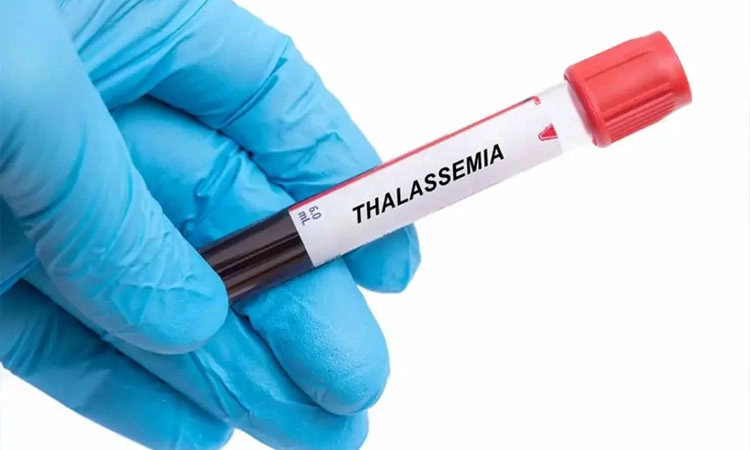 Thalassemia: ತಲಸ್ಸೇಮಿಯಾ ರೋಗಿಗಳು ಗುಣಮುಖರಾಗಬಹುದೇ?