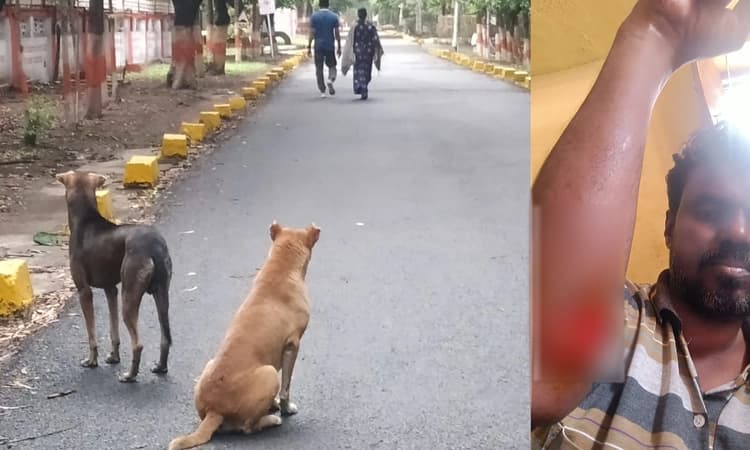 ಬೆನ್ನಟ್ಟಿದ ಬೀದಿನಾಯಿಗಳ ಹಿಂಡು : ತಪ್ಪಿಸಿಕೊಳ್ಳುವ ಭರದಲ್ಲಿ ಬಿದ್ದು ಪತ್ರಕರ್ತನಿಗೆ ಗಾಯ