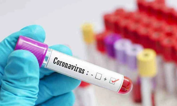 ದಾಸರಹಳ್ಳಿ ವಲಯದ ಎರಡು ಶಾಲೆಯ 31 ವಿದ್ಯಾರ್ಥಿಗಳಲ್ಲಿ ಕೋವಿಡ್ ಸೋಂಕು