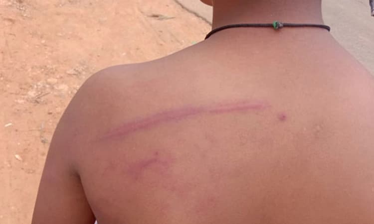 ತಲೆನೋವು ಎಂದು ಹೇಳಿದ್ದಕ್ಕೆ 6ನೇ ತರಗತಿ ವಿದ್ಯಾರ್ಥಿಗೆ ಬಾಸುಂಡೆ ಬರುವಂತೆ ಹಲ್ಲೆ!