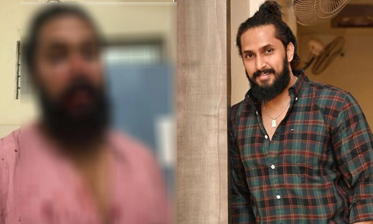 Kannada Actor: ಕನ್ನಡದ ಯುವನಟ ಚೇತನ್‌ ಚಂದ್ರ ಮೇಲೆ 20 ಮಂದಿಯಿಂದ ಹಲ್ಲೆ