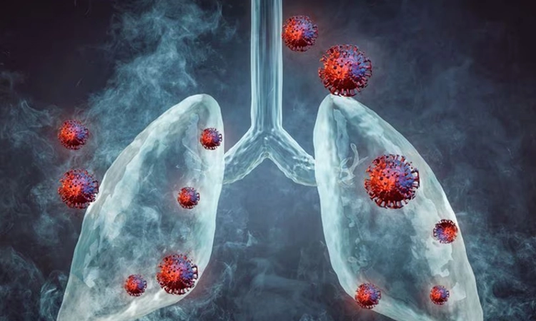 HMPV Virus: ಭಾರತದ ಮೊದಲ ಎಚ್‌ಎಂಪಿವಿ ಸೋಂಕು ಪ್ರಕರಣ ಬೆಂಗಳೂರಿನಲ್ಲಿ ಪತ್ತೆ