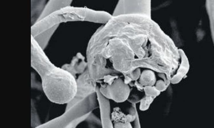 ಕಲ್ಪತರು ನಾಡಿನಲ್ಲಿ ಕಪ್ಪು ಶಿಲೀಂಧ್ರದ ಭೀತಿ!