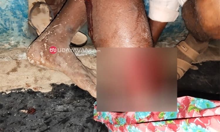 Kushtagi: ಕೋತಿ ದಾಳಿಗೆ ಊರಿನ 15 ಜನರಿಗೆ ಗಾಯ; ಕೋತಿ ಸೆರೆಹಿಡಿಯಲು ಮುಂದಾದ ಅರಣ್ಯ ಇಲಾಖೆ