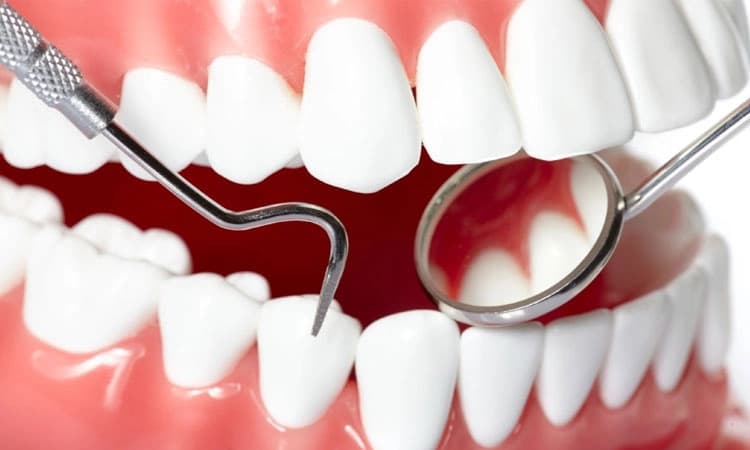 Health: ಬಾಯಿಯ ಆರೋಗ್ಯ: ಕೆಲ ಸಾಮಾನ್ಯ ಸುಳ್ಳು ಮತ್ತು ನಿಜ