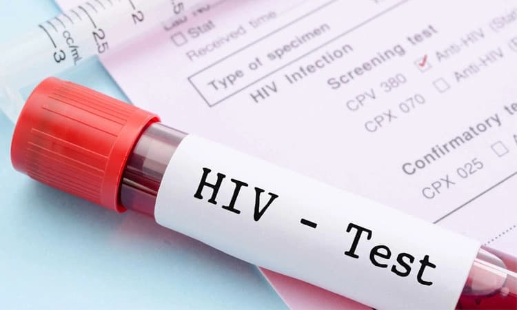 HIV: ಪೋಷಕರ ಮೂಲಕ ಮಗುವಿಗೆ ಹರಡುವ ಎಚ್‌ಐವಿ ಸೋಂಕು