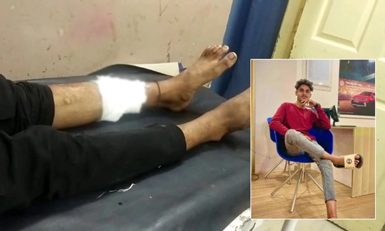 ಪೊಲೀಸರ ಮೇಲೆ ಹಲ್ಲೆ ಮಾಡಿ ಪರಾರಿಯಾಗಲು ಯತ್ನ… ಅತ್ಯಾಚಾರ ಆರೋಪಿ ಕಾಲಿಗೆ ಗುಂಡೇಟು