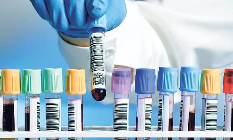 LABತಪ್ಪಲಿದೆ ಜಿಲ್ಲಾಸ್ಪತ್ರೆ ಅಲೆದಾಟ: ರೋಗ ಪರೀಕ್ಷೆಗೆ ತಾಲೂಕು ಆಸ್ಪತ್ರೆಗಳಲ್ಲೂ ಪ್ರಯೋಗಾಲಯ